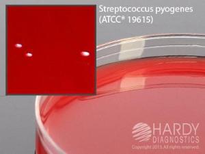 Blood agar, 10% sheep in Tryptic Soy Agar (TSA) base