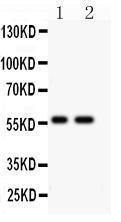 Anti-E3 SUMO-protein ligase PIAS4 Rabbit Polyclonal Antibody