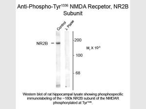 NMDA NR2B SUBUNIT Phospho Y133