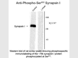 SYNAPSIN I Phospho S603 antiBO