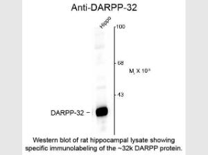 DARPP-32 antibody 100 μl