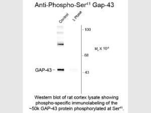 Neuromodulin (GAP43) PS41 anti