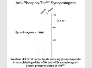 SYNAPTOTAGMIN Phospho T202 ANT