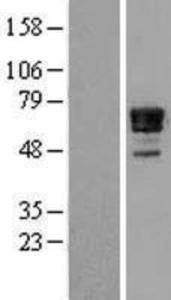 Nab2 Overexpression Lysate (Adult Normal), Novus Biologicals (NBL1-13453)