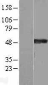 Synaptotagmin 4 Overexpression Lysate (Adult Normal)-Western Blot