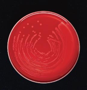 Trypticase™ soy agar, with 5% sheep blood (TSA II)