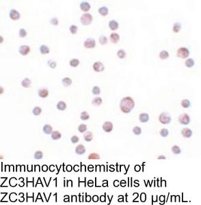 Anti-ZC3HAV1 Rabbit Polyclonal Antibody