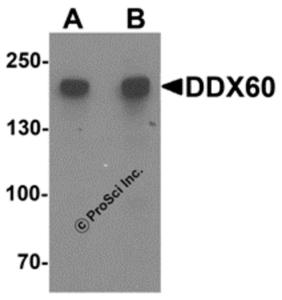 Western blot analysis of DDX60 in A20 cell lysate with DDX60 antibody at (A) 1 and (B) 2 ug/mL.