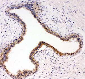 Anti-TRKC Rabbit Polyclonal Antibody