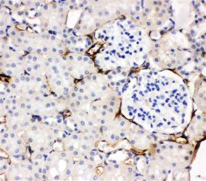 Anti-APMAP Rabbit Polyclonal Antibody