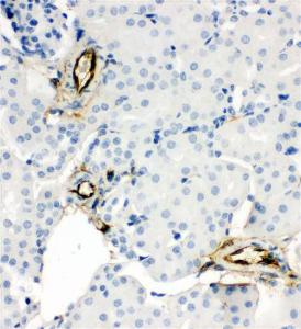 Anti-APMAP Rabbit Polyclonal Antibody