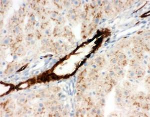 Anti-APMAP Rabbit Polyclonal Antibody