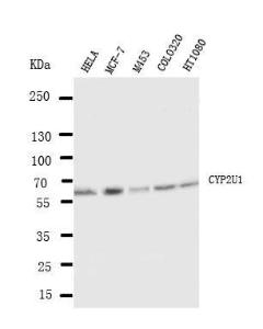 Anti-CYP2U1 Rabbit Polyclonal Antibody