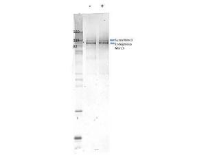 MORC 3 antibody 25 µl