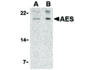 AES A-term antibody 100 µg