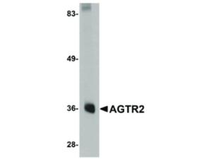 AGTR2 antibody 100 µg