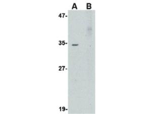Human AKIRIN2 antibody 100 µg