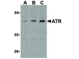 ATR antibody 100 µg