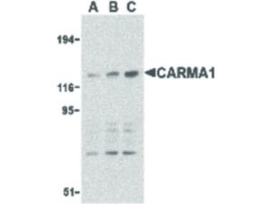CARMA1 antibody 100 µg