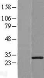 MORN3 Overexpression Lysate (Adult Normal), Novus Biologicals (NBL1-13186)
