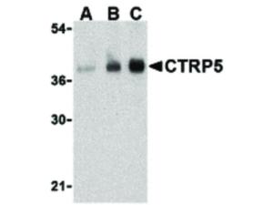 CTRP5 antibody N-term 100 µg