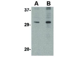 DNAL1 antibody 100 µg