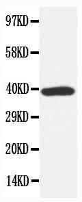 Anti-HSP40 Rabbit Polyclonal Antibody