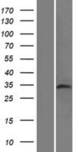TAF8 Overexpression Lysate (Adult Normal)-Western Blot