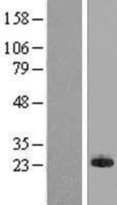 MPHOSPH6 Overexpression Lysate (Adult Normal), Novus Biologicals (NBL1-13198)