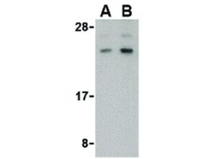 BANF1 C-term antibody 100 µg
