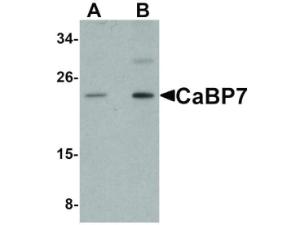 CABP7 antibody 100 µg