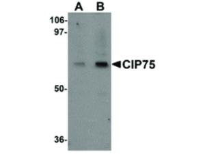 CIP75 antibody 100 µg