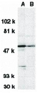 DRAK1 antibody 100 µg