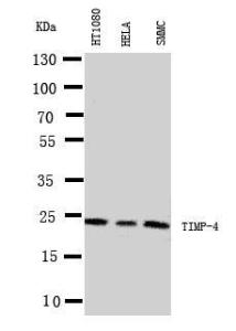 Anti-TIMP4 Rabbit Polyclonal Antibody