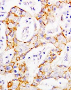 Anti-CTNNB1 Rabbit Polyclonal Antibody