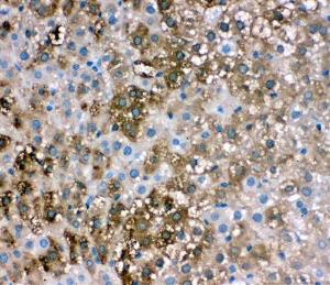 Anti-liver FABP Rabbit Polyclonal Antibody