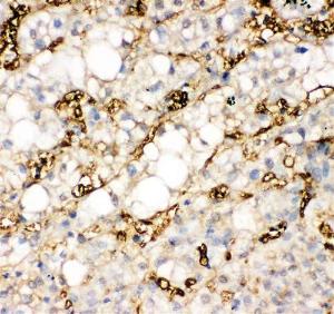 Anti-liver FABP Rabbit Polyclonal Antibody