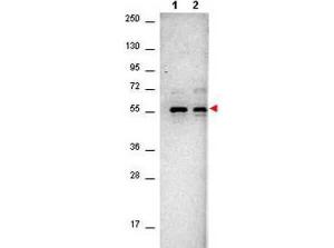Anti-AKT PAN antibody 25 µl