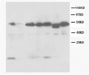 Anti-Caspase-8(P18) Rabbit Polyclonal Antibody