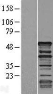 Dematin Lysate (Adult Normal), Novus Biologicals (NBP2-11410)