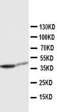 Anti-CK19 Rabbit Polyclonal Antibody