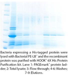 Protein Extraction and Lysis Buffer (PE LB™) Systems, G-Biosciences