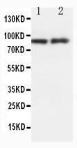Anti-HSP90B1 Rabbit Polyclonal Antibody