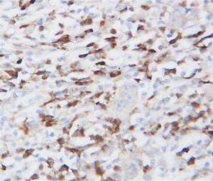 Anti-HSP90B1 Rabbit Polyclonal Antibody