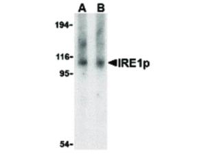 PAB Rabbit IRE1P Human IgG 100 µg ELISA