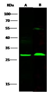 Anti-SNAP-25 antibody, rabbit polyclonal western blot (WB)