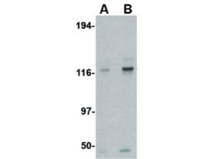 PAB Rabbit KIF 5 Human MS Rat IgG 100 µg