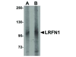 PAB Rabbit LRFN1 Human IgG 100 µg ELISA