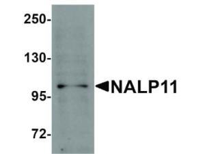 PAB Rabbit NALP11 Human IgG 100 µg ELISA