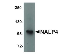 PAB Rabbit NALP4 Human IgG 100 µg ELISA